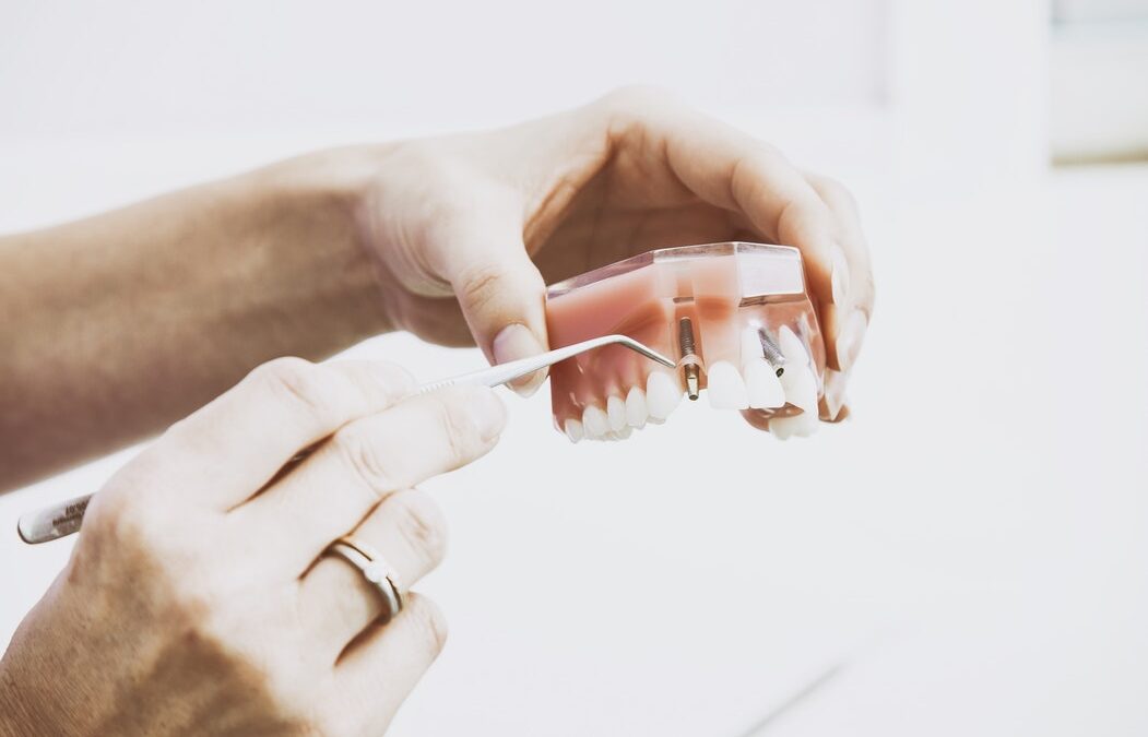 How Are Dentures Made